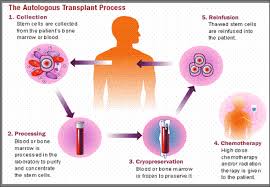 Figuur 1: Autologe stamceltransplantatie