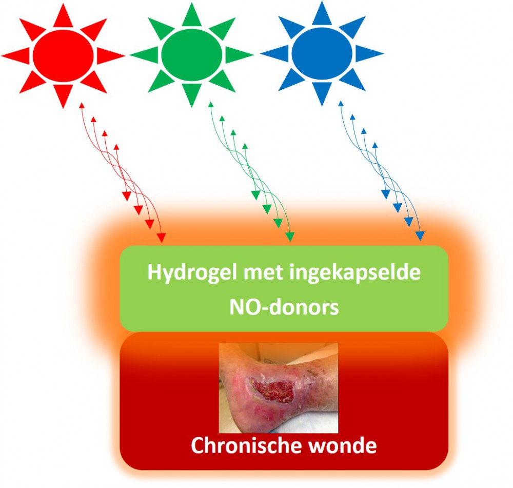 Een illustratie van het concept voor een nieuw wondverband dat in ontwikkeling is, waarbij door invloed van licht stikstofmonoxide vrijgegeven wordt en de wondgenezing verbetert.