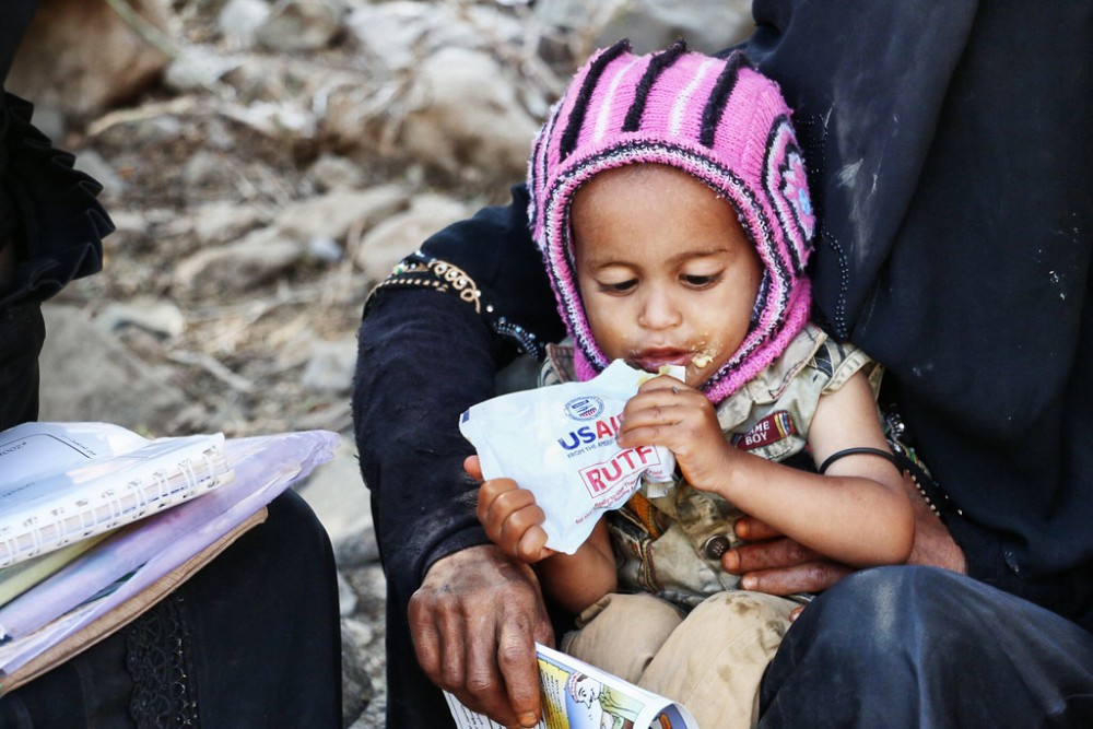 Een kind in Jemen eet uit een voedselzak 