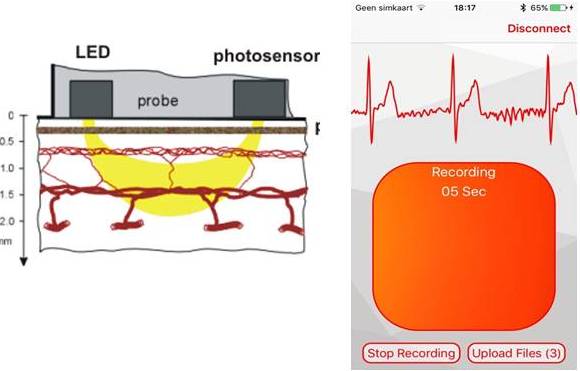 Links: visuele voorstelling van de werking van app (fotoplethysmografie). Rechts: 1-afleiding-ECG tijdens meting.