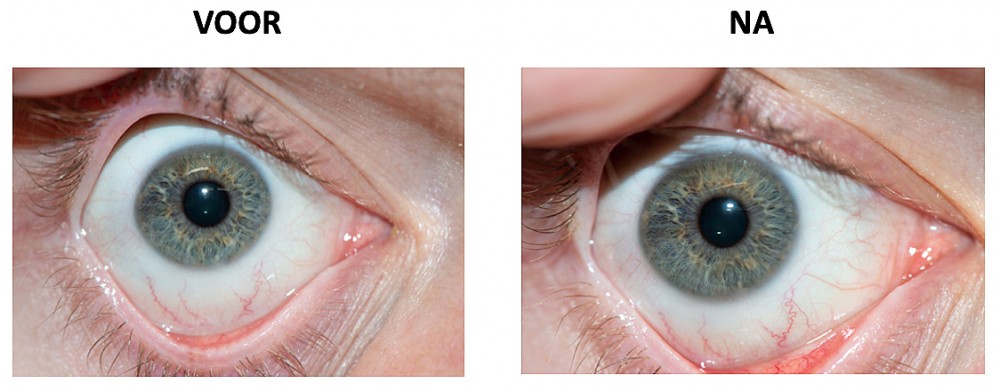 Weergave van het oog met zwembril