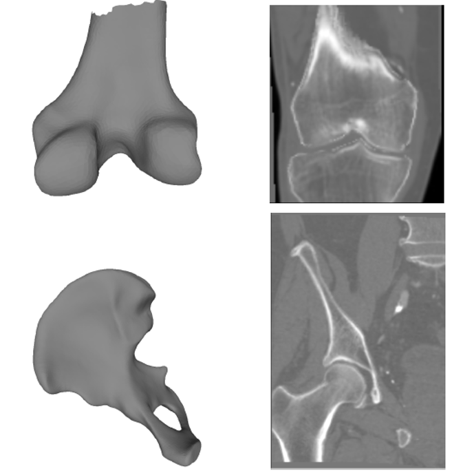 Gegenereerde 3D-modellen en CT scans