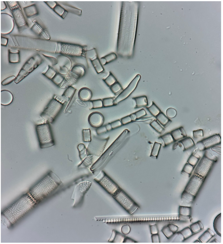 Lichtmicroscopisch beeld waarin verschillende soorten diatomeeën zichtbaar zijn.