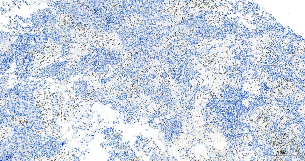 Figuur 2. Microscopisch beeld van de IHC-kleuring voor BAP1 op pleura. Beelden gescand met Pannoramic-250 (3DHISTECH) op vergroting 10X en Schaal 0,200mm.