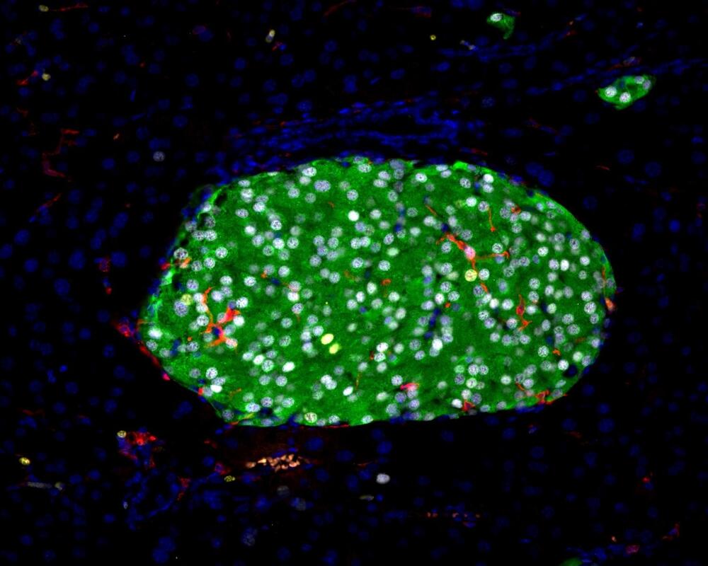 Figuur 1 -  Immunofluorescente kleuring van een pancreatisch eilandje. Insuline-positieve bètacellen zijn weergegeven in groen, terwijl macrofagen in het rood zijn weergegeven. 