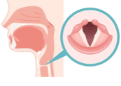 Glottis Stock Photos and Pictures - 161 Images | Shutterstock
