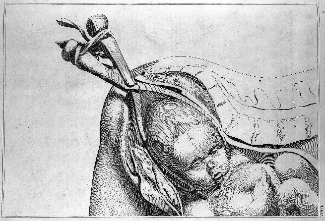 Afbeelding met schets, tekening, illustratie, Drukkunst</p>
<p>Automatisch gegenereerde beschrijving